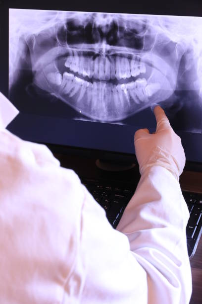 Best Emergency Root Canal Treatment in South Bend, WA