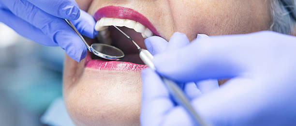Best Urgent Care for Lost Fillings or Crowns in South Bend, WA